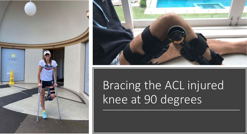 Lachman test for ACL injuries