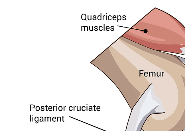 Diagram of the posterior cruciate ligament of the knee
