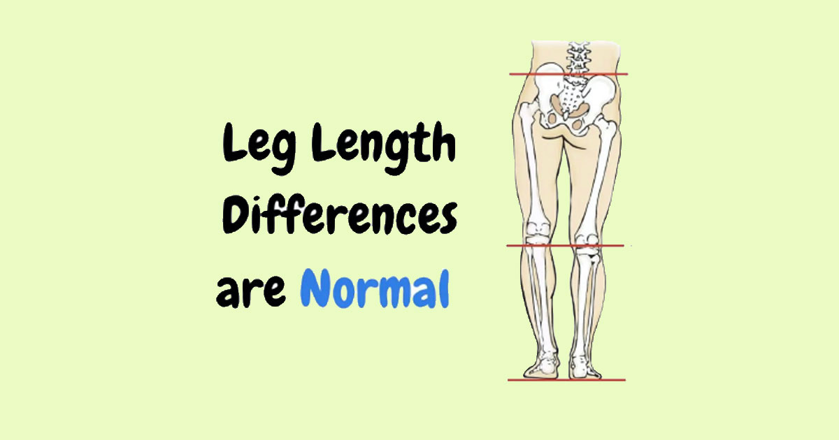 90% of the population will have some form of leg length difference.  Additionally, research found the average difference was 5.2mm and deemed insignificant.