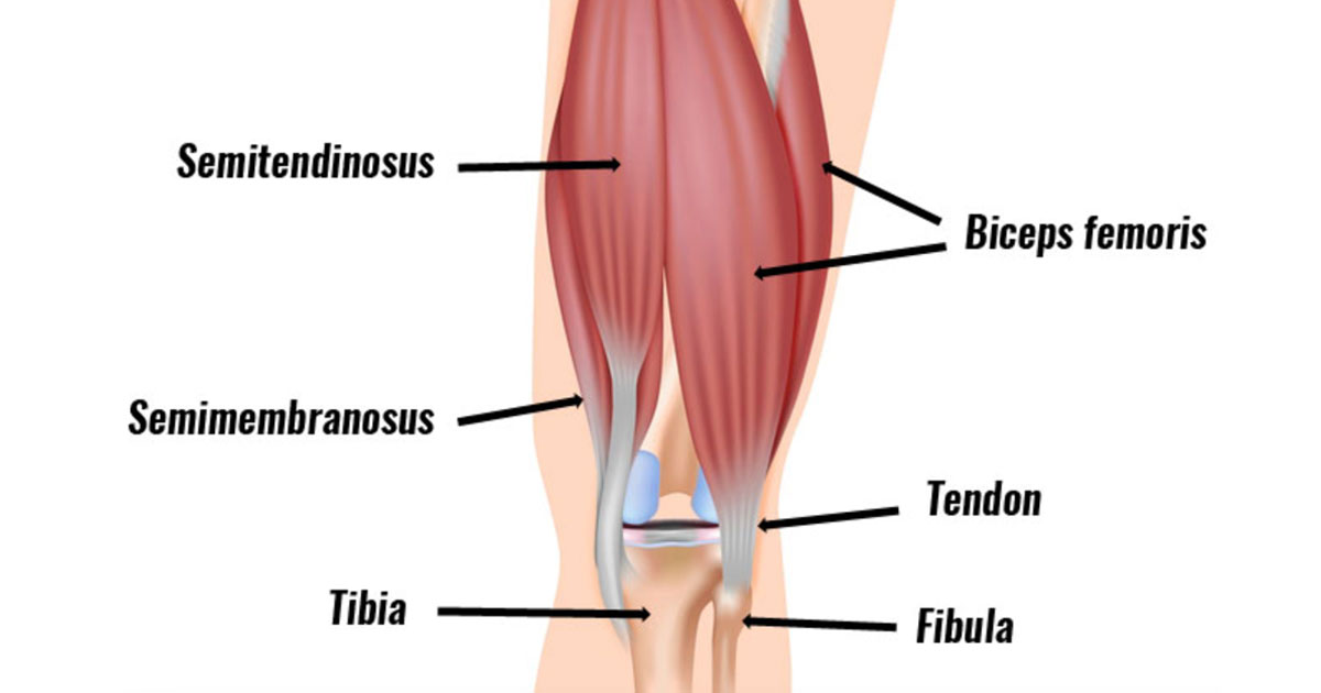 Hamstring strains are a common musculoskeletal injury, particularly among athletes and individuals engaged in physical activities.