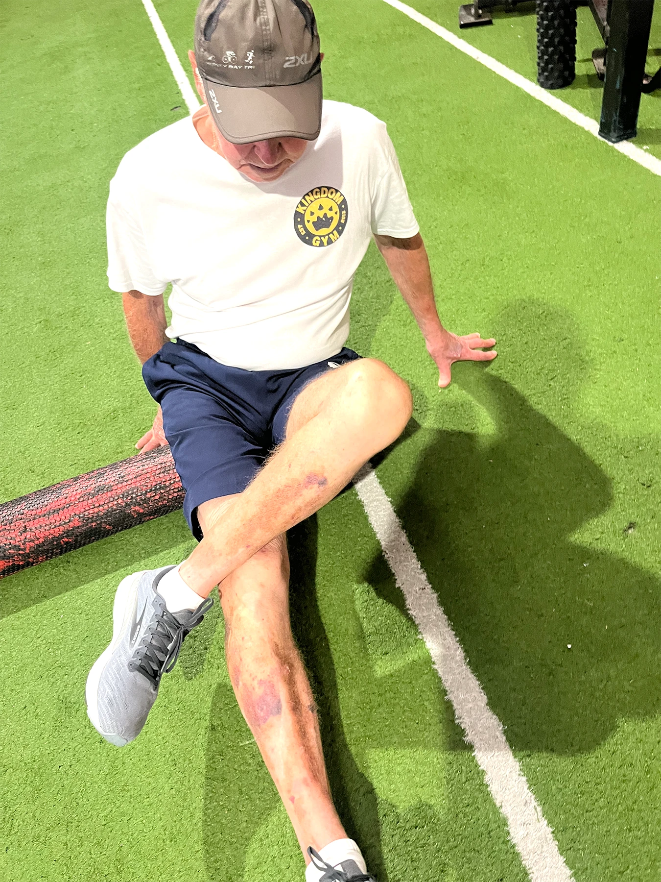 Patient at Sports and Spine Physiotherapy in Brookvale - Northern Beaches doing specific exercises as part of a prehabilitation program